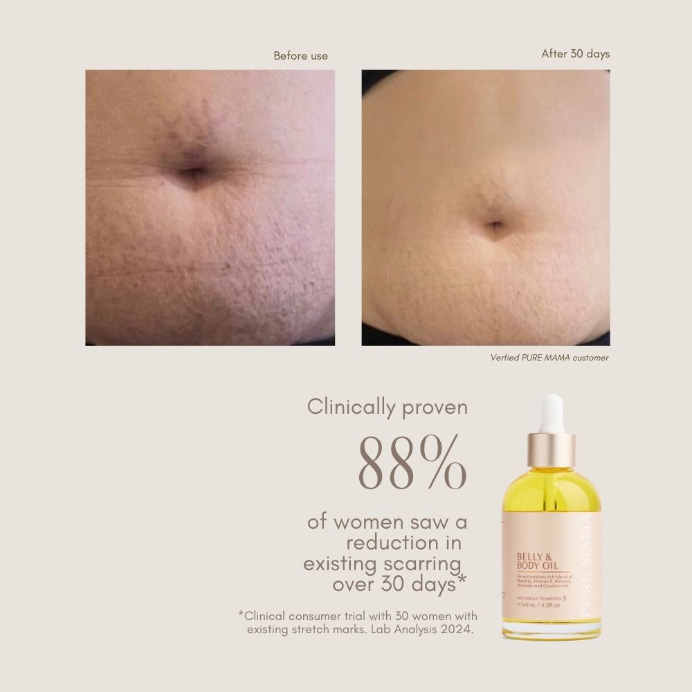 Pure Mama Belly & Body Oil (145ml)